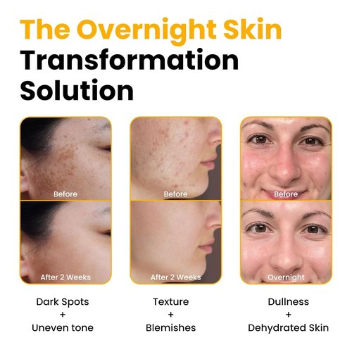 MEFELE Cln Peel Off Mask,Collagen Face Mask, Hydrating Overnight Hydrogel Mask,Gentle Skin Care, Pore Minimizing - Korean Skincare -Elasticity Improvement - Better Than Sheet Masks