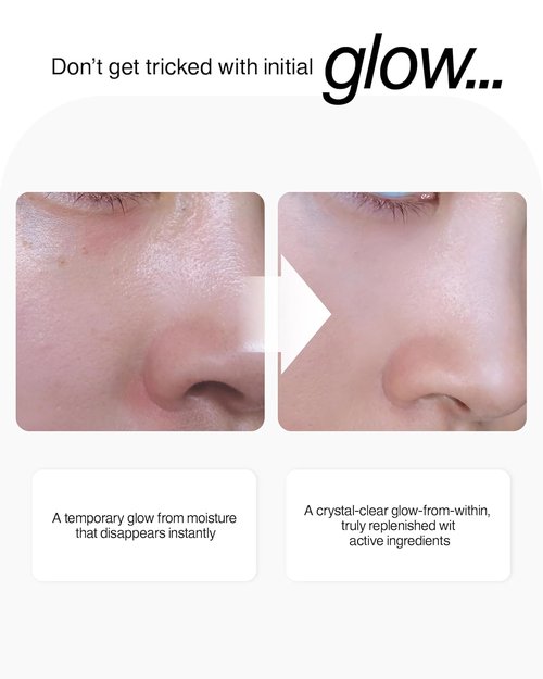 ECTO-PDRN Anti-Aging Serum - 10% Extreme Dose with Vegan PDRN, Ectoin & Panthenol | 30ml