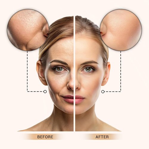 Lx Blend Bye Bye Foundation - Oil-Free Matte Coverage Moisturizer with SPF 50 | Medium 1 FL OZ