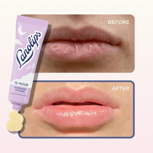 Lanolips 12 Hour Overnight Lip Mask - Hydrating Lip Balm with Hyaluronic Acid & Vitamin C - Restore & Soften While You Sleep - 0.52 oz / 15 g