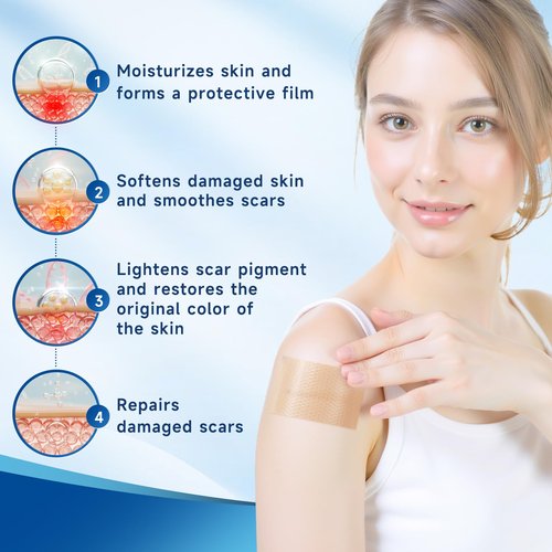 Rvlaim Silicone Scar Sheets, Silicone Scar Tape(5.7” x 1.57” 10 Pcs), Silicone Scar Sheets for Surgical Scars, Keloid Bump Removal, Stretch Marks Removal, C-Section, Burn et