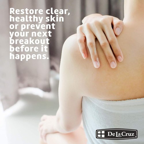 De La Cruz Sulfur Ointment - Effective Cystic Acne Treatment for Face & Body - 2.6 OZ Tube