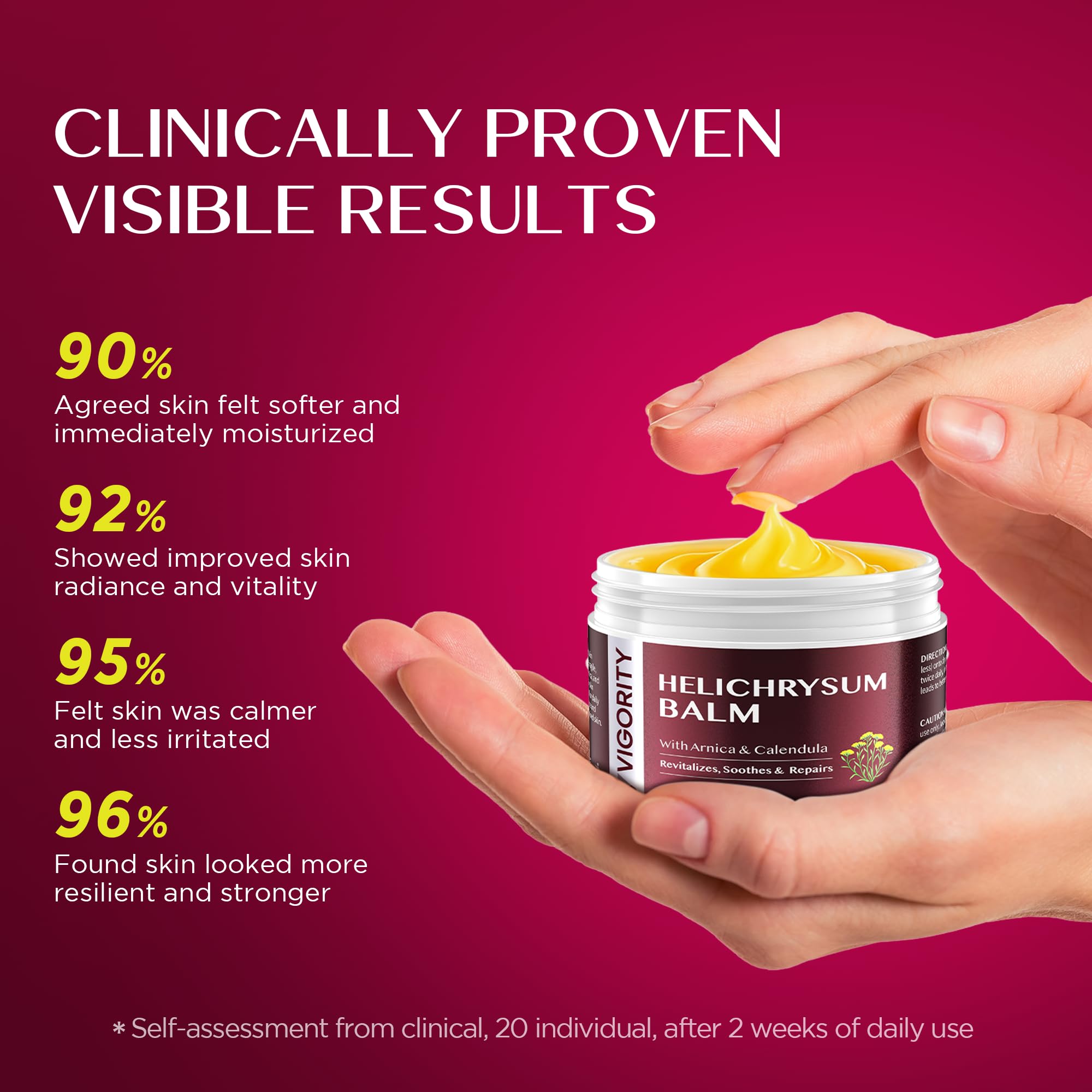 Vigority Helichrysum Balm Soothes & Repairs: Restorative Cream with Arnica & Calendula for Thin, Fragile, Bruised & Aging Skin – Moisturizes & Revitalizes Face & Body – Whipped Texture – 3.4 oz