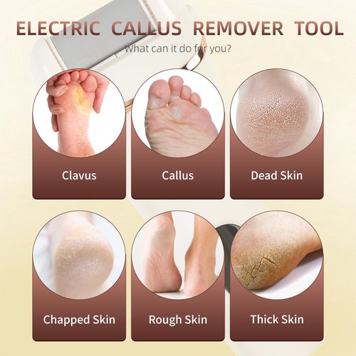 Meyluth Electric Callus Remover for Feet, 17-in-1 Professional Pedicure Kit, Foot Scrubber Electric Foot File for Hard Cracked Dry Dead Skin, 3 Rollers, 2 Speed, Battery Display