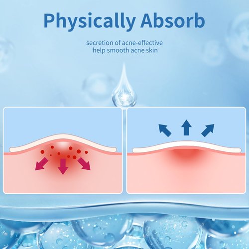 Daolyo Pimple Patches for Face - 3 Size 510 Counts Hydrocolloid Acne Patches for Covering Zits and Blemishes, Spot Stickers with Salicylic Acid, Tea Tree Oil & Calendula Oil(8mm,10mm,12mm)