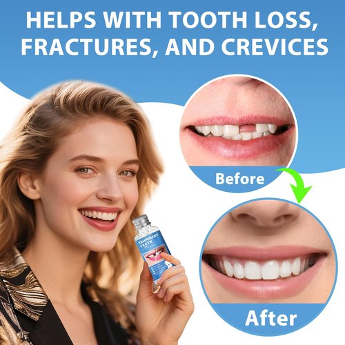 Tooth Repair Kit, Moldable False Teeth Beads for Teeth Repair, Suitable for Missing, Cracked DIY Denture Kit, 1PCS-K1