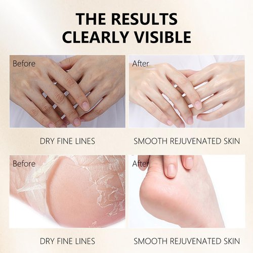GUOYAOLIFU Hydrating Hand Foot Masks Set for Women Men,3 Pack Glove Mask for Dry Hand & 3 Pack Socks Mask for Dry Cracked Feet（Milk）