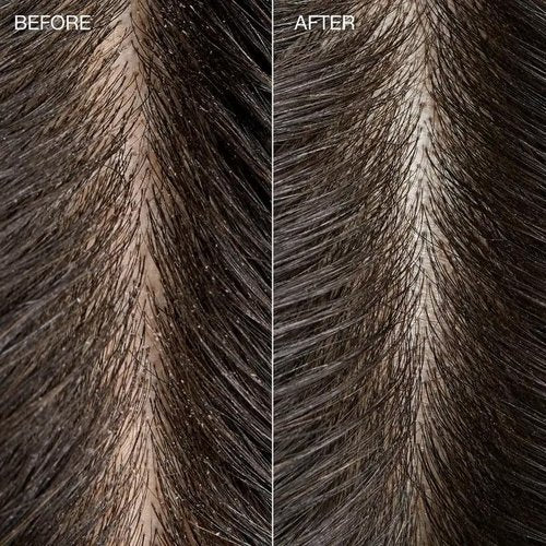 Tea Tree Special Detox Kombucha Rinse - Removes Buildup & Adds Shine for All Hair Types