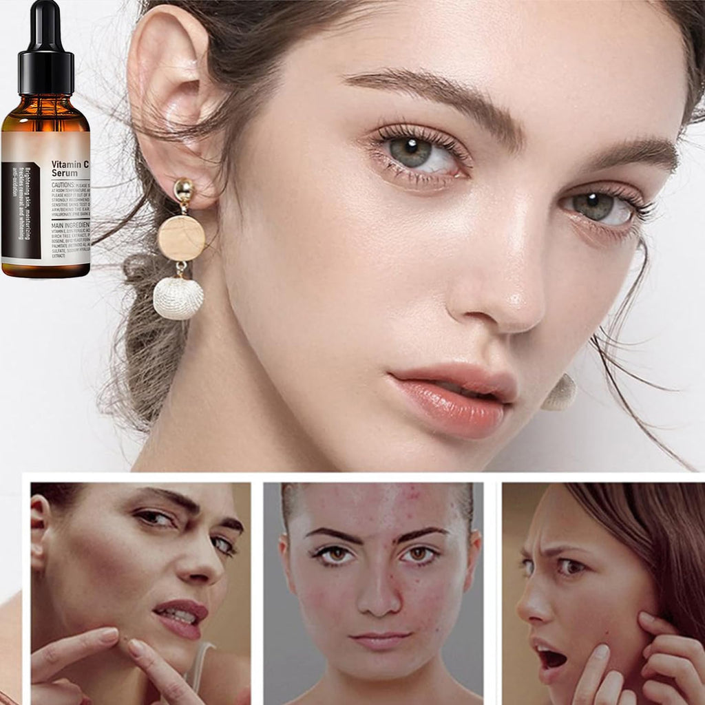 Vitamin C Serum For Face, Anti Aging Face Serum with Vitamin C, Hyaluronic Acid, Vitamin E – Brightening Formula – Improve Appearance of Dark Spots, Tone, Fine Lines & Wrinkles (2Pcs)