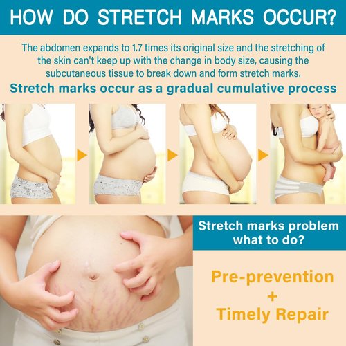 PEGO Stretch Mark Butter - Maternity Cream for Pregnancy & Postpartum Care | Hypoallergenic 100g/3.53oz