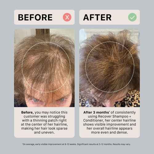 ACTIIV Ultimate Power Trio for Women - Boost Fuller-Looking Hair & Strengthen Scalp | Vegan, Color-Safe Shampoo, Conditioner & Serum