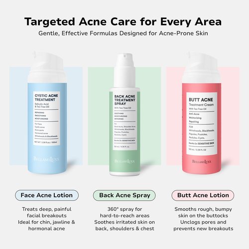 BellamiLuxx Cystic Acne Treatment for Face: Hormonal Acne Treatment Cream for Teens & Adults - Salicylic Acid & Tea Tree Oil Pimple Spot Remover - Anti-Acne Moisturizer Reduces Redness, Blemishes