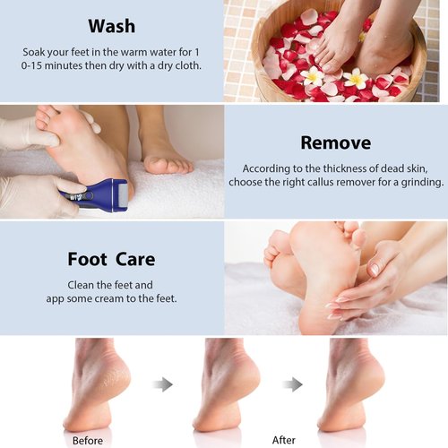 AdamPark Electric Callus Remover for Feet, Rechargeable Portable Electronic Foot Callus Remover 2-in-1 Wet/Dry Foot Scrubber Electric Toot File for Hard Cracked Dry Dead Skin（Blue）
