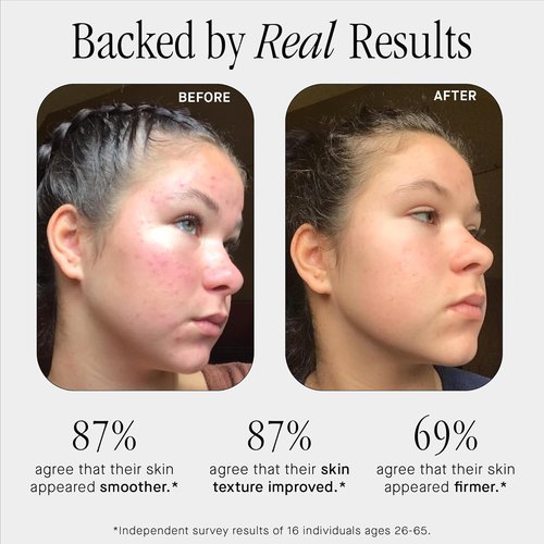 Brandefy Niacinamide Serum - Hydrating Peptides & Hyaluronic Acid for Bright, Smooth Skin | 1oz, Made in the USA