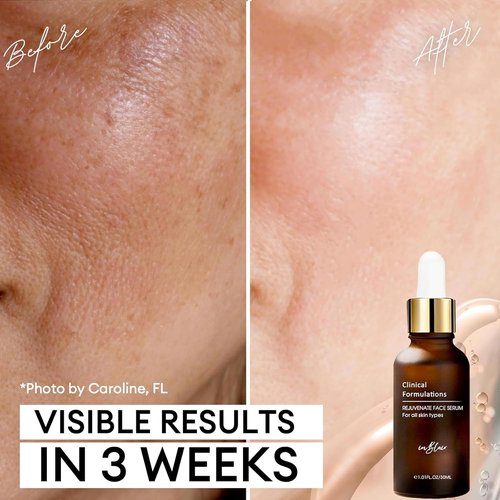 Rejuvenate Resurfacing Face Serum - Anti-Aging Formula for Wrinkles & Dark Spots - 1 fl. oz.