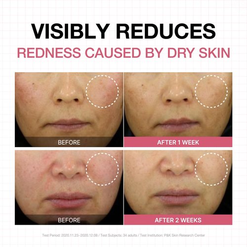 Physiogel Calming Relief Face and Body Lotion, Reduces Redness in just 3 days, Moisturizer for Dry, Red, Itchy, Sensitive Skin, Korean skin care, Fragrance-Free, Non-Comedogenic, Dermatologist-Tested