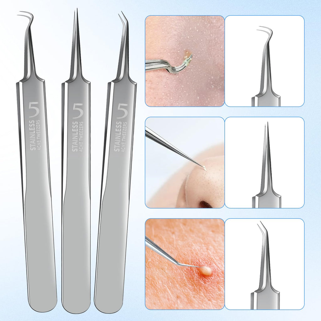 YGQQOY Blackhead Remover Tweezers, Pimple Popper Tool Kit, Ingrown Hair Tweezers, Blackhead Extractor, Skin Zit Acne Blemish Popping Removing Surgical Tweezers Tools for Nose Eye Face