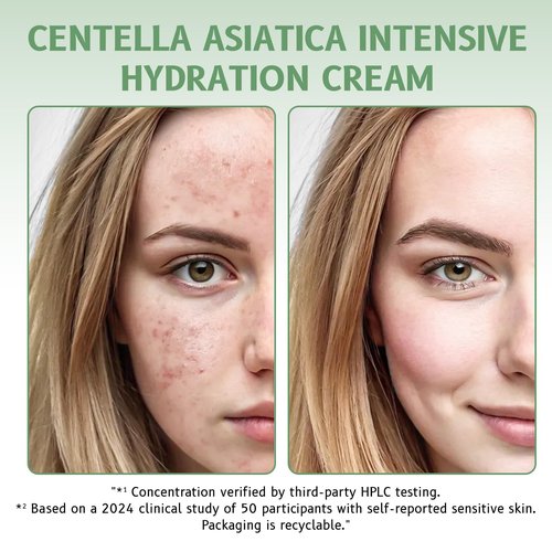 GROEI Centella Asiatica Intensive Hydration Cream, 85% Natural Ingredients, Long-Lasting Moisturizer for Sensitive Skin, 50g