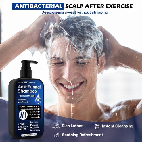 Skiennix Antifungal Psoriasis Shampoo - Relieves Scalp Itching & Dryness | 10.1 Fl Oz, Sulfate-Free