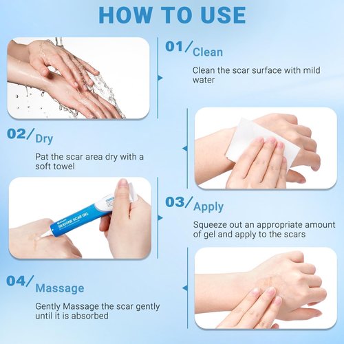Kunyle Silicone Scar Gel, Scar Cream, Advanced Scar Stick for Surgical Scars, Stretch Marks, Keloid Bump Removal, Old and New Scars 0.63oz (18g)