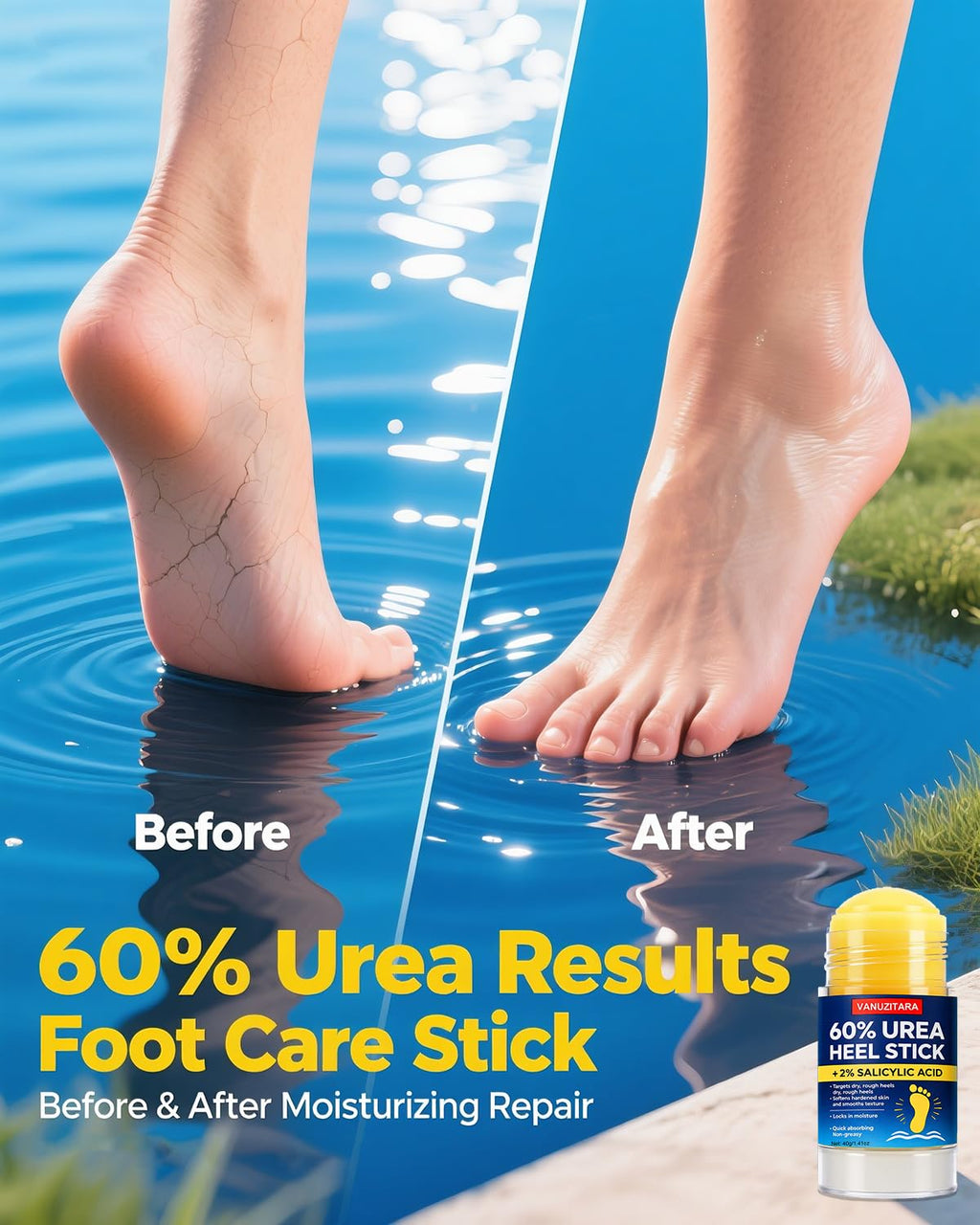Urea Cream 60% by [Brand Name] - Maximum Strength Foot & Hand Cream with 2% Salicylic Acid | 1.41oz