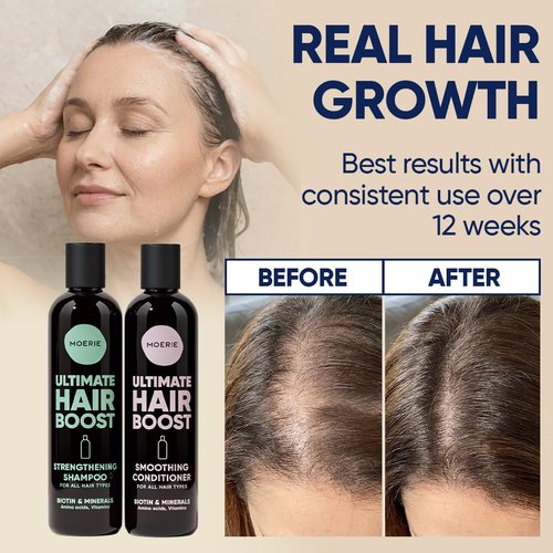Moerie Hair Growth Shampoo & Conditioner | Biotin & Rosemary Formula for Thinning Hair – Promotes Regrowth