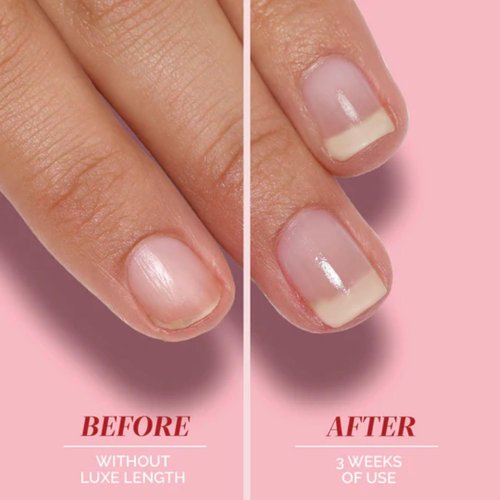 LONDONTOWN Nail Strengtheners - Boost Growth, Repair & Shine for Weak, Brittle Nails - Clear Formula