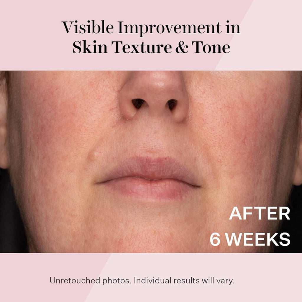 StriVectin Advanced Retinol Serum - Targets Visible Signs of Aging for Healthier Skin