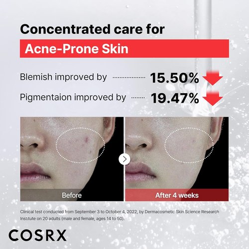 COSRX 15% Niacinamide Face Serum - Pore Minimizer for Even Skin Tone | 0.67 fl oz Korean Skincare