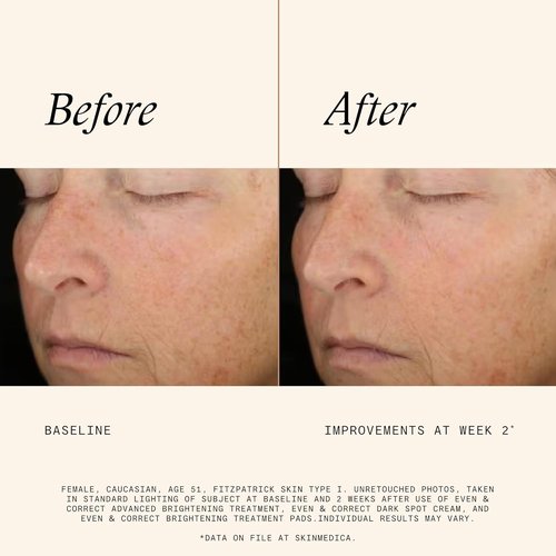 SkinMedica Even & Correct Brightening Treatment Pads - Exfoliating 10% Glycolic Acid, 60 Ct