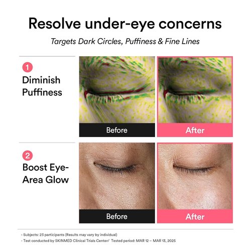 Abib PDRN Retinal Eye Patches - Rejuvenate Puffy Eyes with Glow Jelly & Niacinamide | 60 Count