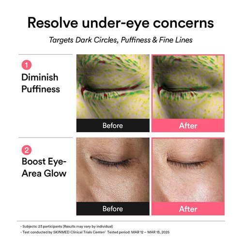 Abib PDRN Retinal Eye Patch, Hydrogel Masks for Dark Circles, Puffiness, Fine Lines, 60 Patches, 84g, with Niacinamide, K-Beauty Skincare