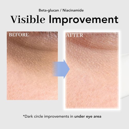 NOWATER Collagen Eye Cream - Reduce Wrinkles, Puffiness & Dark Circles | Hydrolyzed Collagen, 0.88 fl. oz.