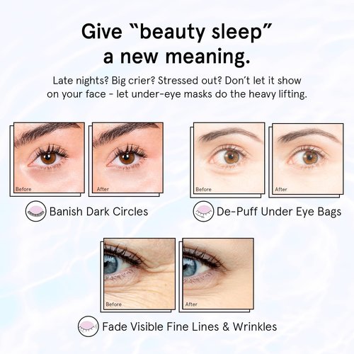 Grace & Stella Retinol Under Eye Patches - Hydrating Gel Masks for Puffy Eyes & Dark Circles | 24 Pairs in Purple