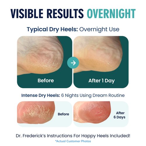 Dr. Frederick's Moisturizing Heel Socks - Olive Oil & Vitamin E Infused for Cracked Heels - 2 Pairs - Green Aloe