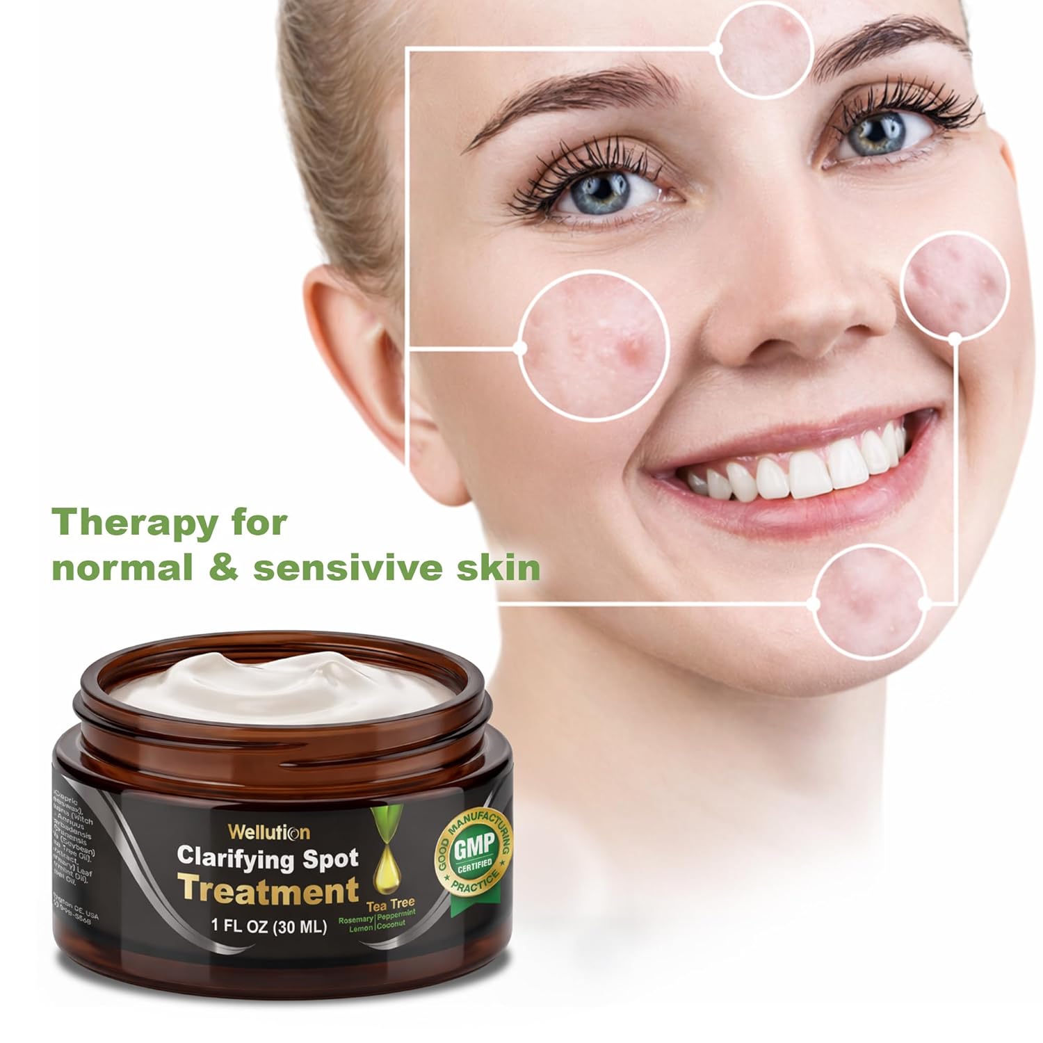 WELLUTION Cystic Acne Spot Treatment - Fast-Acting Tea Tree Cream for Pimples & Blemishes - 1oz Non-Greasy Formula