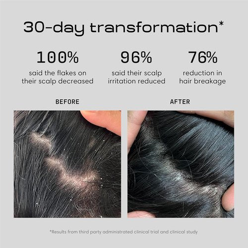 Jupiter Anti-Dandruff Shampoo | Nourishing Conditioner & Serum for Flaky, Itchy Scalp - Color-Safe, Sulfate-Free