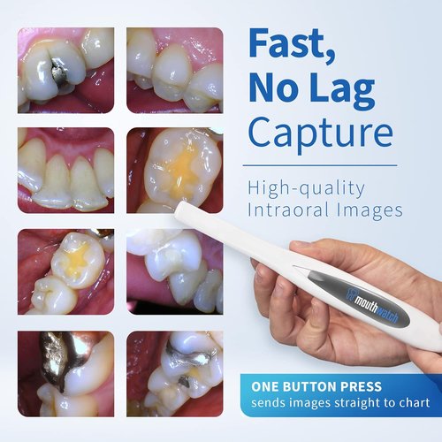 Intraoral Camera - Crystal Clear Images | Easy Single Button Operation, Lightweight & Ergonomic, 31g