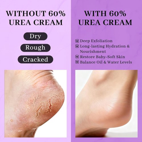 Urea Cream 60% by [Brand Name] - Maximum Strength 5-in-1 Moisturizer for Rough, Dry Skin | 150g