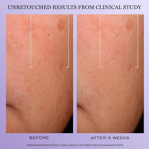 Lancôme Rénergie H.C.F. Triple Serum - Anti-Aging Hyaluronic Acid Formula with Vitamin C+, Niacinamide & Ferulic Acid