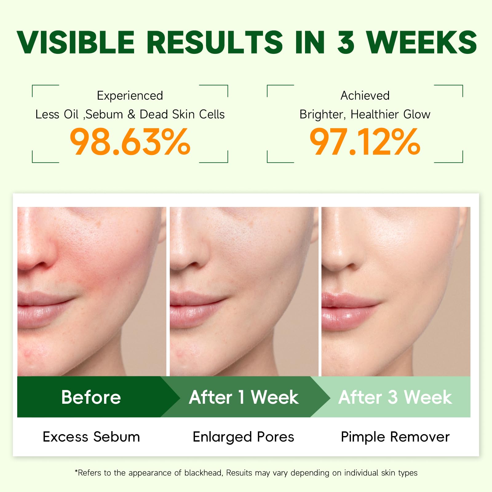 100 Count Toning Polish Pads, Skincare Toner Pads for Dark Spots, Wrinkles & Dull Skin - Hydrating Facial Treatment with Snail Mucin, Niacinamide, Peptides & Centella