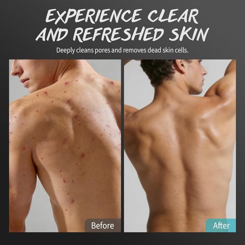 Skiennix Men’s Body Scrub - Exfoliating Tea Tree Oil Formula for Smooth Skin | 10% AHA, 2% BHA