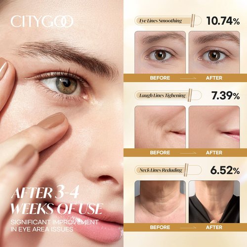 CITYGOO Retinol Eye Stick Hydrating: Dark Circle & Puffiness Balm with Retinol & Collagen - Anti Aging Wrinkle Cream For Women - Travel Friendly and Korean Skin Care 0.35oz/10g