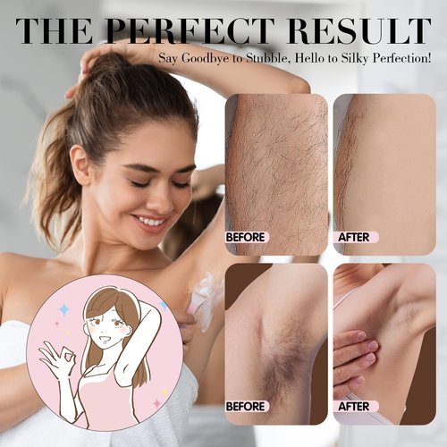 Hair Removal Cream for Legs, Arms & Underarms – Painless Depilatory Cream with Floral Vanilla Scent, Gentle Formula for Women & Men, Smooth Skin at Home in 8 Minutes