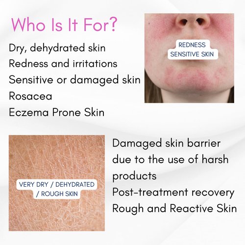 Skin Barrier Repair Serum – Restores and Supports the Skin Barrier, Strengthens & Soothes Sensitive Skin | Ceramides + EGF (Oligopeptide-1)+ Oat Extract + Probiotic Complex | Fragrance-Free (1 fl oz)