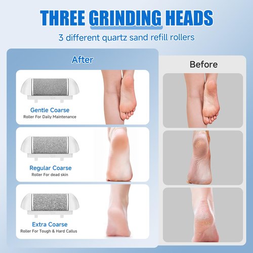 Electric Callus Remover for Feet, Professional Pedicure Tools Foot Care Kit, Portable Rechargeable Electric Feet File, Waterproof Foot File, Perfect for Foot Scrubber Dead Skin