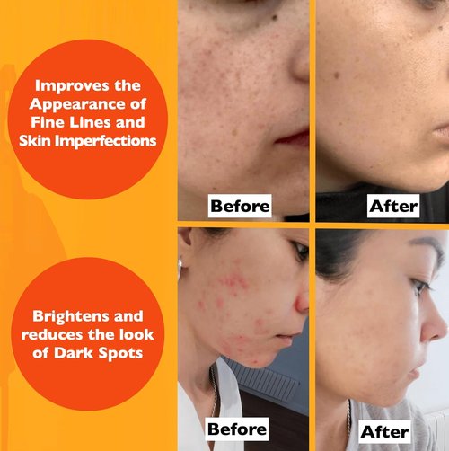 Regine Switzerland Vitamin C Serum - Anti-Aging Face Serum with Hyaluronic Acid & Vitamin E | Brightening Formula for Dark Spots & Fine Lines, 2 Fl Oz