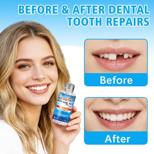 Moldable False Teeth Beads, DIY Temporary Tooth Replacement Kit, Suitable for Missing, Broken and Chipped Tooth Repair Beads, Thermoplastic Beads, Make You Smile Confidently