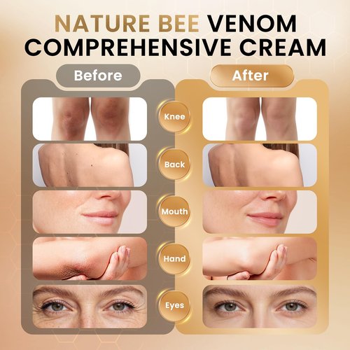 Bee Venom Cream - Natural Bee Venom Skin Treatment Cream - Firming & Wrinkle Reduction, Collagen Boost & Skin Brightening, Moisturizer for Face & Body, All Skin Types, 2.1oz
