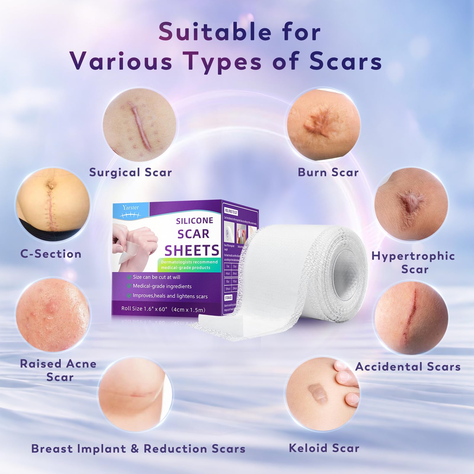 Yarster Silicone Scar Sheets, Silicone Scar Tape(1.6"x 60" Roll-1.5M), Medical Grade Scar Sheets, Scar Tape for Surgical Scars, Burn, C-Section, Keloid Scars, Acne Treatment, Stretch Marks Removal